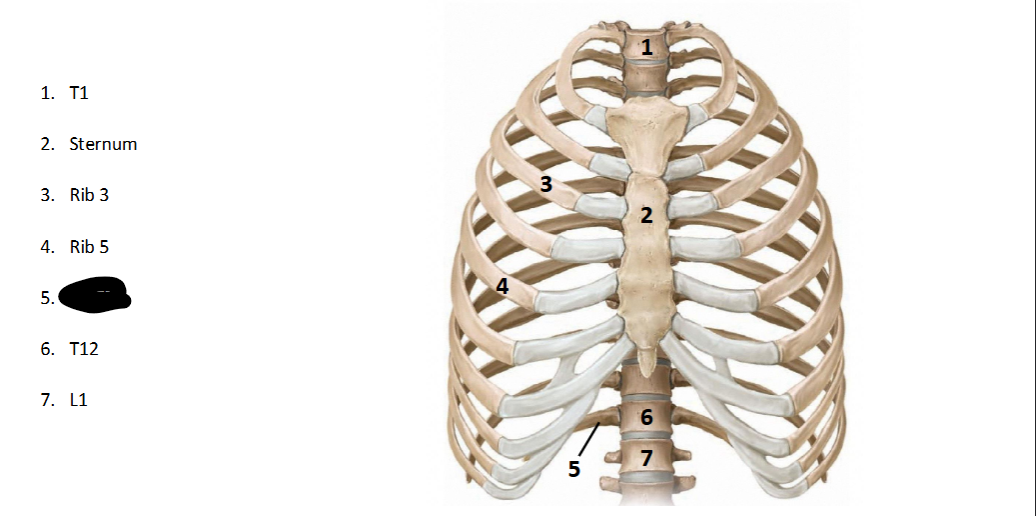 <p>What structure is this within the <strong>Spine? (ANTERIOR OF AXIAL)</strong></p>