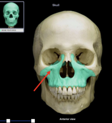 <p>What is the red arrow pointing to?</p>