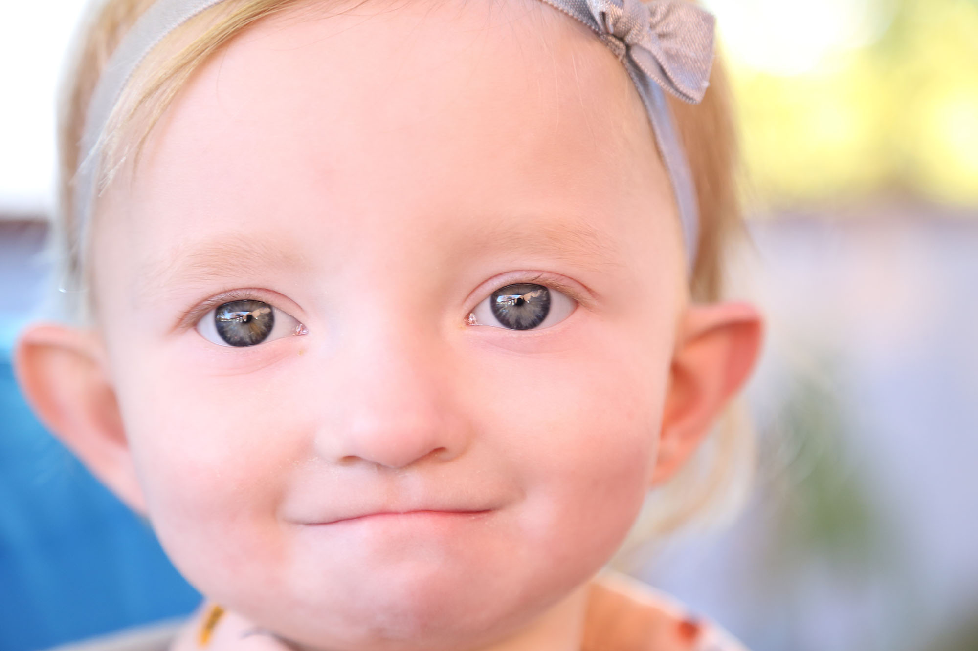 <p>Wolf-Hirschhorn Syndrome</p>