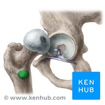 <p>A smaller process on the proximal medial surface of the femur</p>