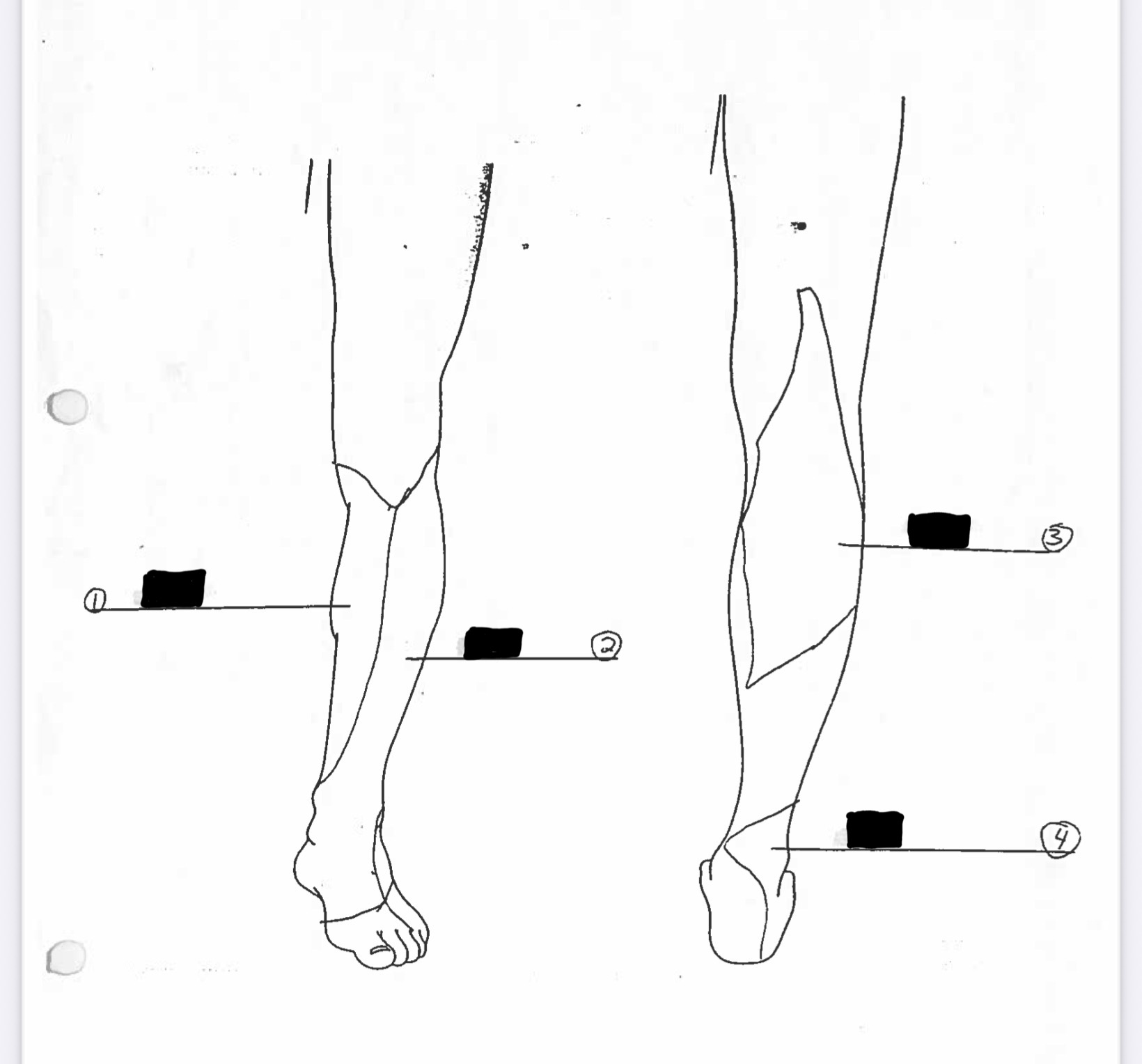<p>Label the dermatomes properly</p>