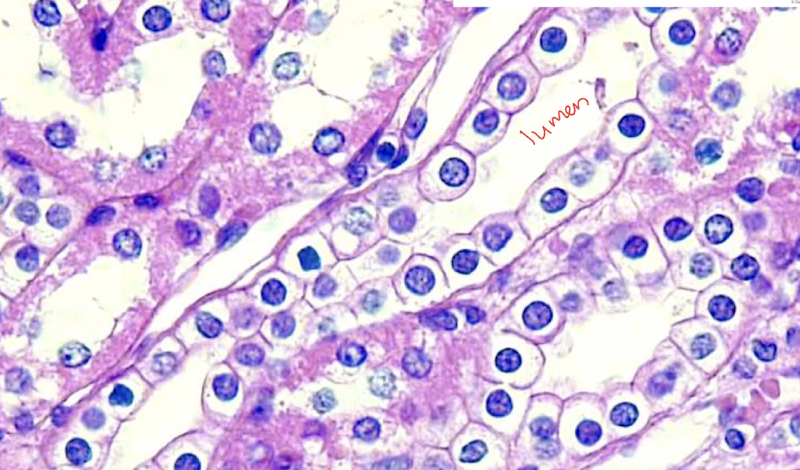 <p>What kind of tissue is this?</p>