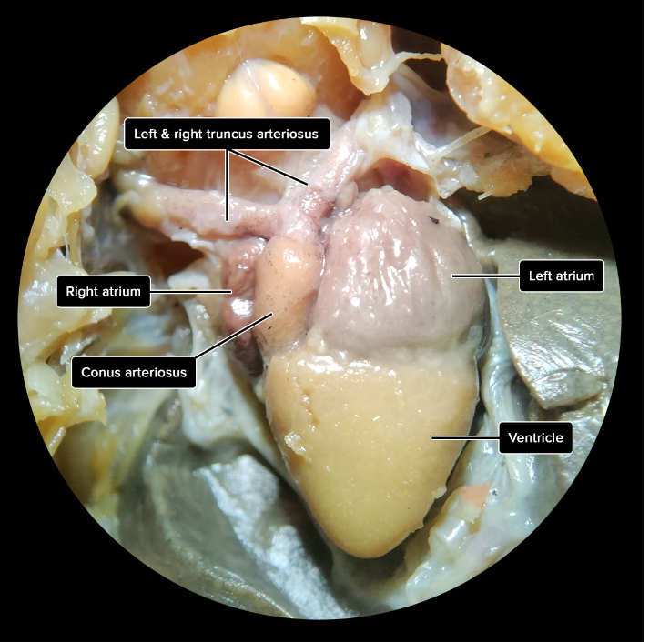 <p><span>What organ is shown here?</span></p>