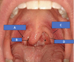 <p>What is D?</p>