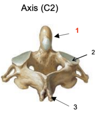 <p>Identify the marking at #3</p>