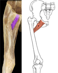 <p>Femoral N</p>