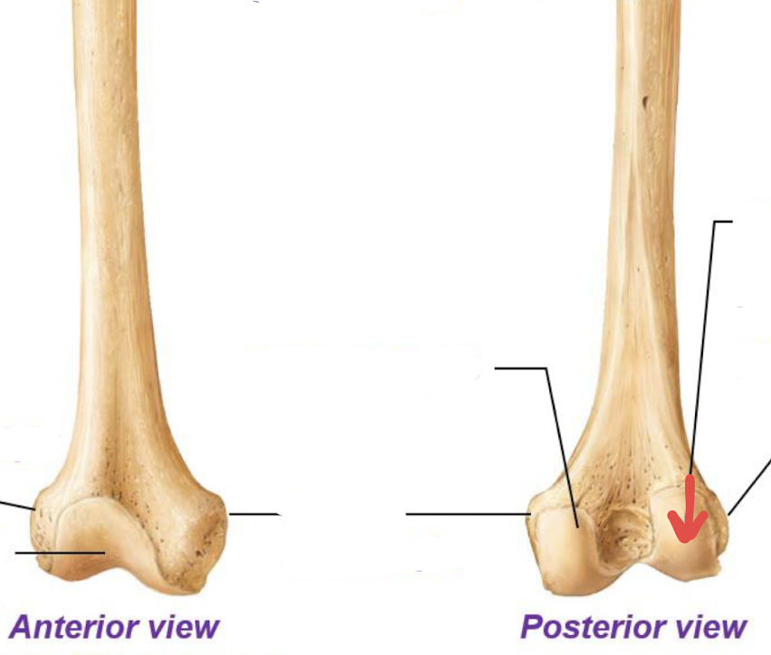 <p>what is this part of the femur?</p>