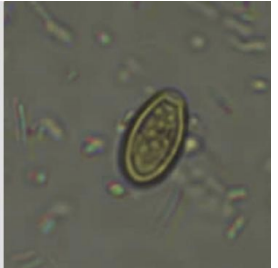 <p>pollen grain in stool that may look like</p>