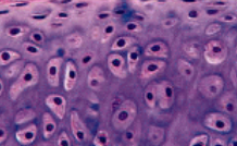 <p>hyaline cartilage</p>