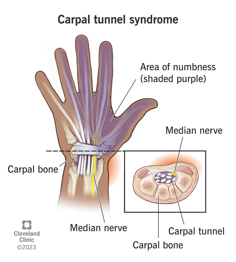 <p>What injury / condition? </p>