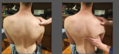 <p>1. side of patient </p><p>2. press shoulder down</p><p>3. push into the inferior lateral aspect of scapula</p>