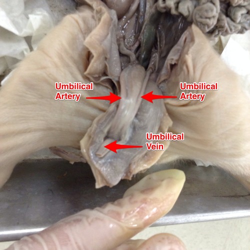 <p><span style="background-color: transparent;">Blood vessel that carries deoxygenated blood and wastes from the fetus to the placenta.</span></p>