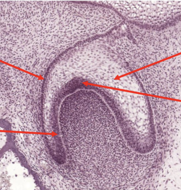 <p>Id the cell layer (top right arrow)</p>