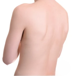 <p>Which way is this person's back leaning?</p>
