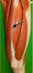 <p>A: crucial in walking and running because it swings legs forward, plays important role in stabilizing patella</p><p>O: linea</p><p>I: patella</p>