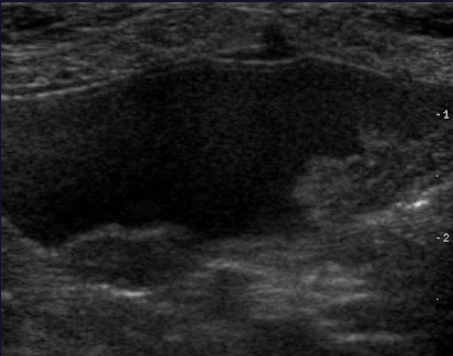 <p>What is shown in this image and what does it likely indicate based on its location </p>