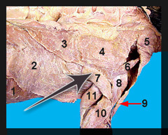 <p>muscle that works together with the acromiodeltoid to raise and rotate the humerus</p>