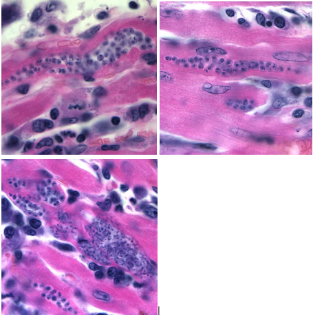 <p>Trypanosoma cruzi, amastigote</p><p>Disease: <u>Chagas disease</u></p><p>Vector: <u>Triatomine/kissing/reduviid bug</u></p><p>Transmission: <u>bugās feces</u></p><p>Infective stage: <u>Metacyclic trypomastigote</u></p><p>Diagnostic stage: <u>Trypomastigote</u></p><p>Treatment: <u>Benznidazole and/or Nifurtimox</u></p>