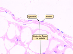 <p>Epithelial tissue. Look at the very top layer of cells. You will single layer of flat cells.</p>