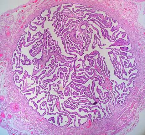 <p>oviduct</p>