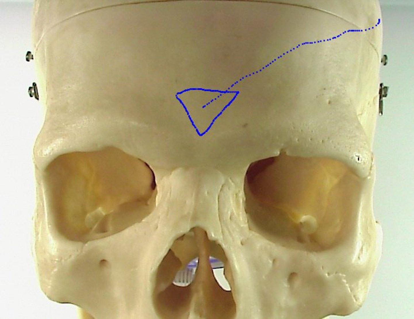 <p>What is this boney feature?</p>