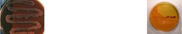 <p>This microorganism appears <strong>pink</strong> on <strong>EMB plates</strong> and <strong>pink/orange </strong>on <strong>HE plates</strong> making it a <strong>lactose fermenter</strong>, which organism is it?</p>