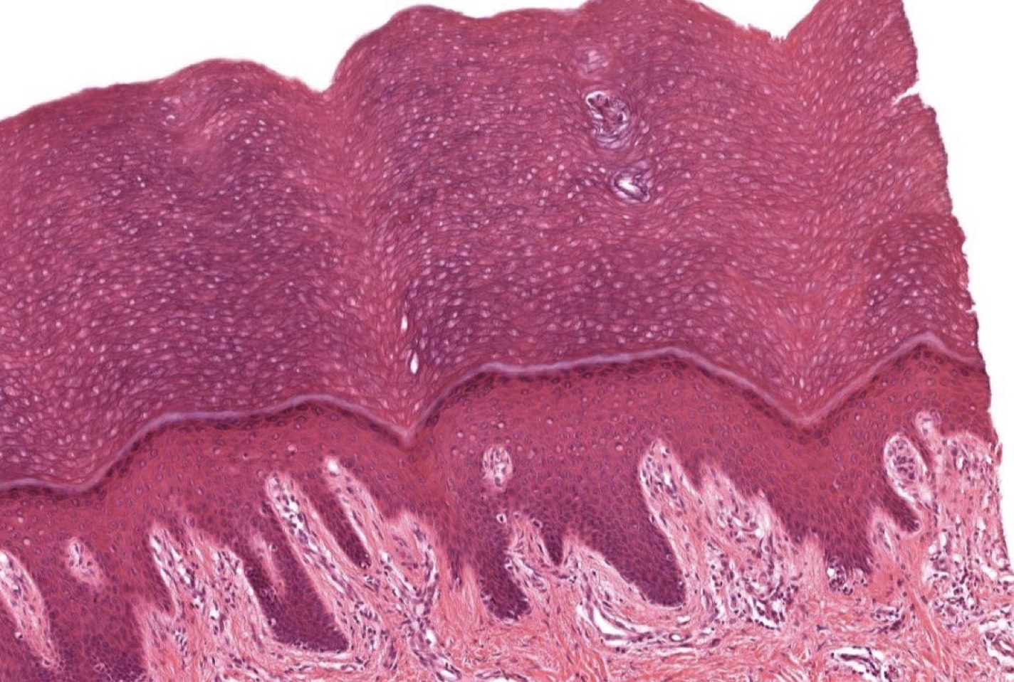 <p>Identify the layer below the keratin?</p>