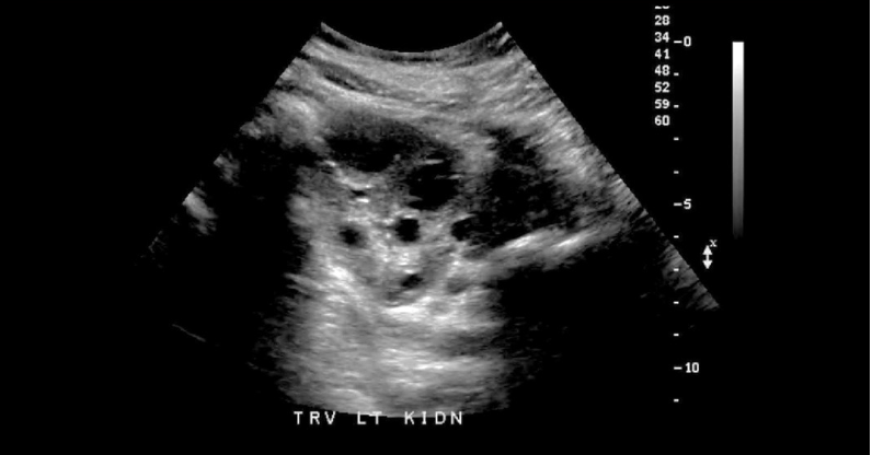 term image