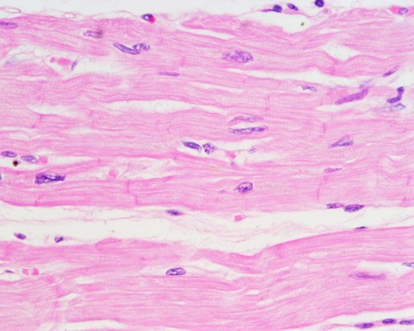 <p>Cardiac muscle tissue occurs only in the wall of the heart. The muscle cells of cardiac muscle are striated muscle, but its contraction is involuntary. Cardiac muscle can contract with no nervous stimulation. The involuntary division of the nervous system regulates contraction of cardiac muscle tissue; we have no direct, conscious control over how fast our heart beats. visceral muscle, a term reflecting the fact that both occur in the visceral organs and are innervated by the involuntary division of the nervous system.</p>