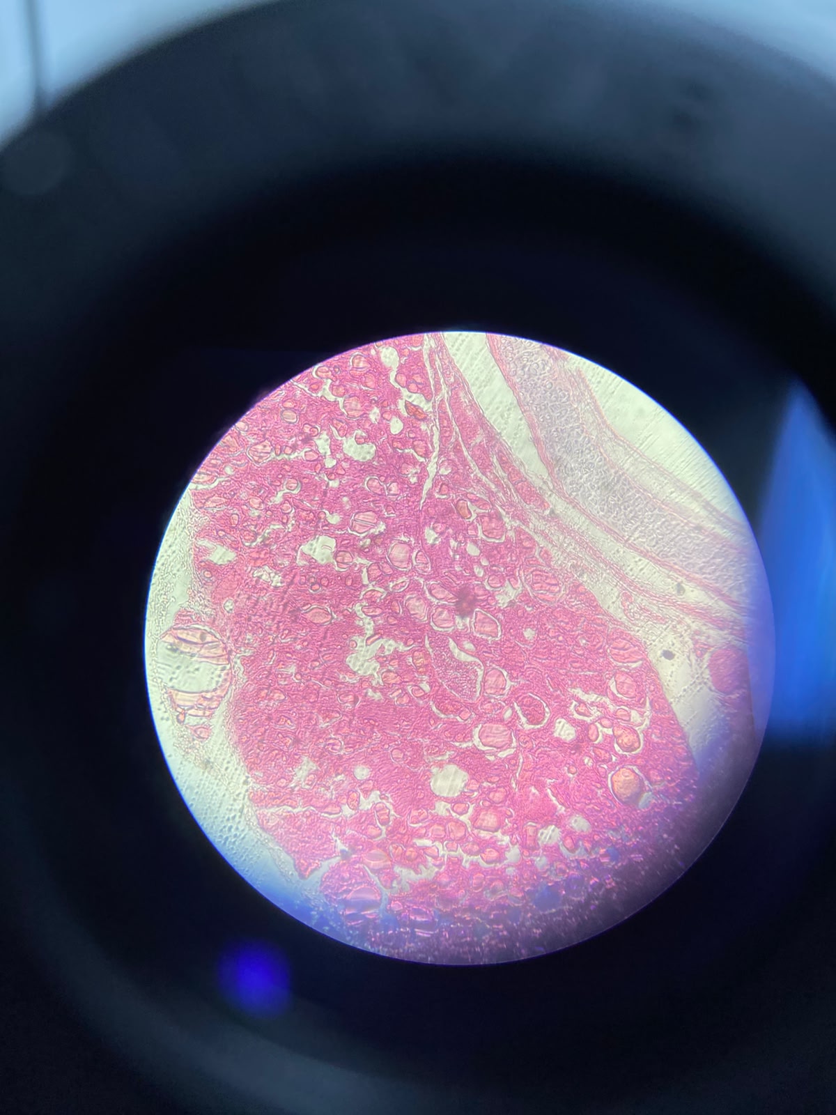<p>Que Lâmina é essa? O que te ajudou a identificar?</p>