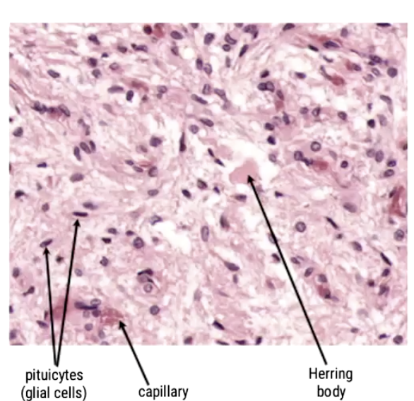 <ul><li><p>The <strong>posterior</strong> pituitary does not produce hormones. It secretes 2 hormones that are produced in the hypothalamus and temporarily stored in Herring bodies before release:</p><ul><li><p>Oxytocin (OXT)</p></li><li><p>Antidiuretic hormone (ADH) - aka vasopressin: prevents the release of fluid from your system</p></li></ul></li><li><p><strong>Pituicytes</strong> (glial cells): Helper cells to maintain the health, repair and structural integrity of neurons</p></li><li><p><strong>Capillary</strong></p></li><li><p><strong>Herring body</strong> - neurons which allow release of the hormones</p></li></ul><p></p>