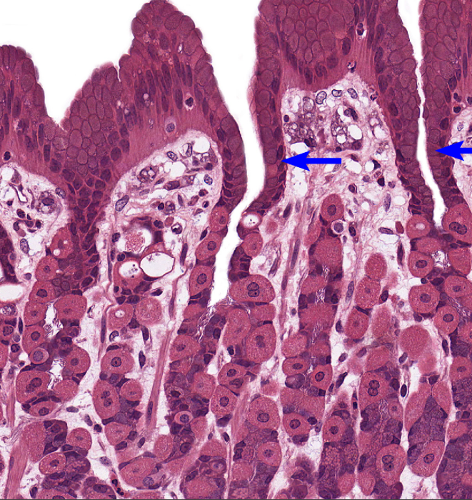 <p>Stomach</p><p><strong>NOTICE: THE DEEP GASTRIC PITS WITH DARK STAINED GASTRIC GLANDS AROUND THEM AND NOT MANY GOBLET CELLS</strong></p>