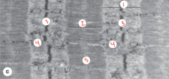 <p>What part of the sarcomere is labeled 4?</p>