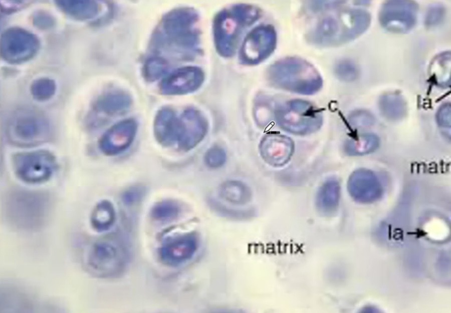 <p>What example of hyaline cartilage </p>