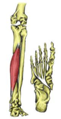 <p>posterior, "Dick", next to Tom, runs under the foot</p>