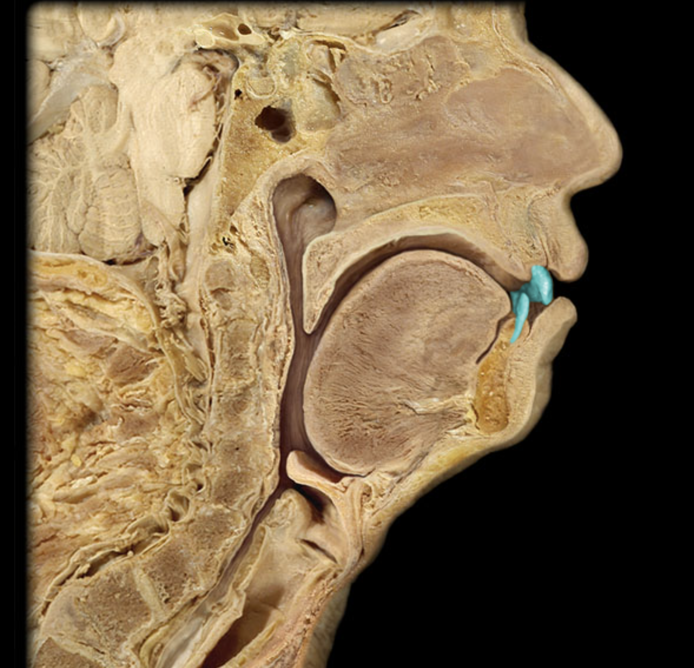 term image