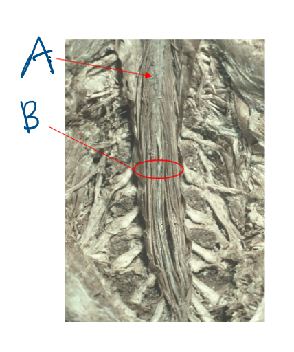 <p>Give the names of A and B and (c) where do these structures exist? (d) What are the names of the ligaments that stabilises the spinal cord?</p>