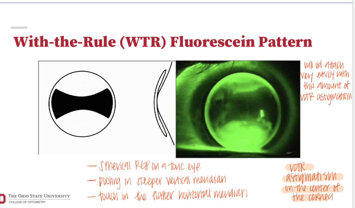 <p>________ Fluorescein Pattern will lid attach very easily</p>