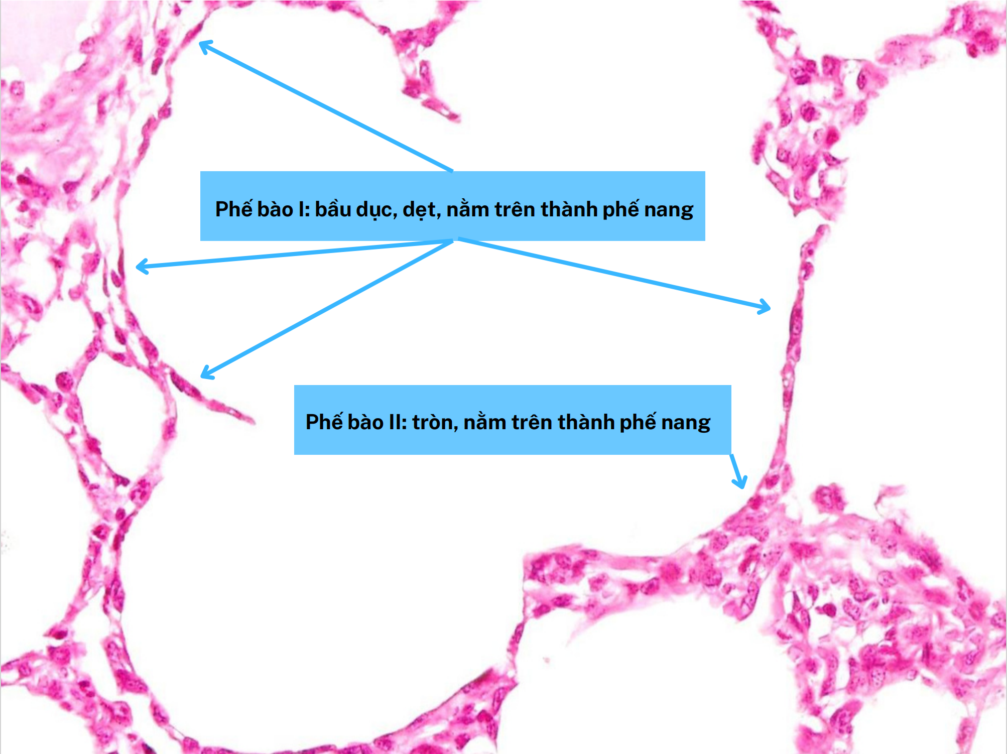 <ol><li><p>Phế bào I</p></li><li><p>Phế bào II</p></li></ol><p></p>