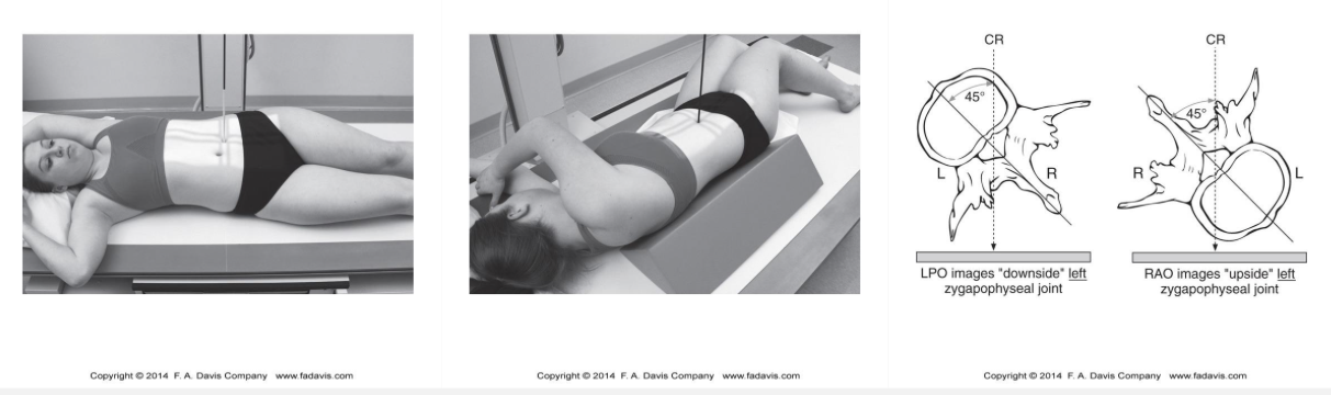 <p>What structures can be visualized in an oblique lumbar spine radiograph?</p>