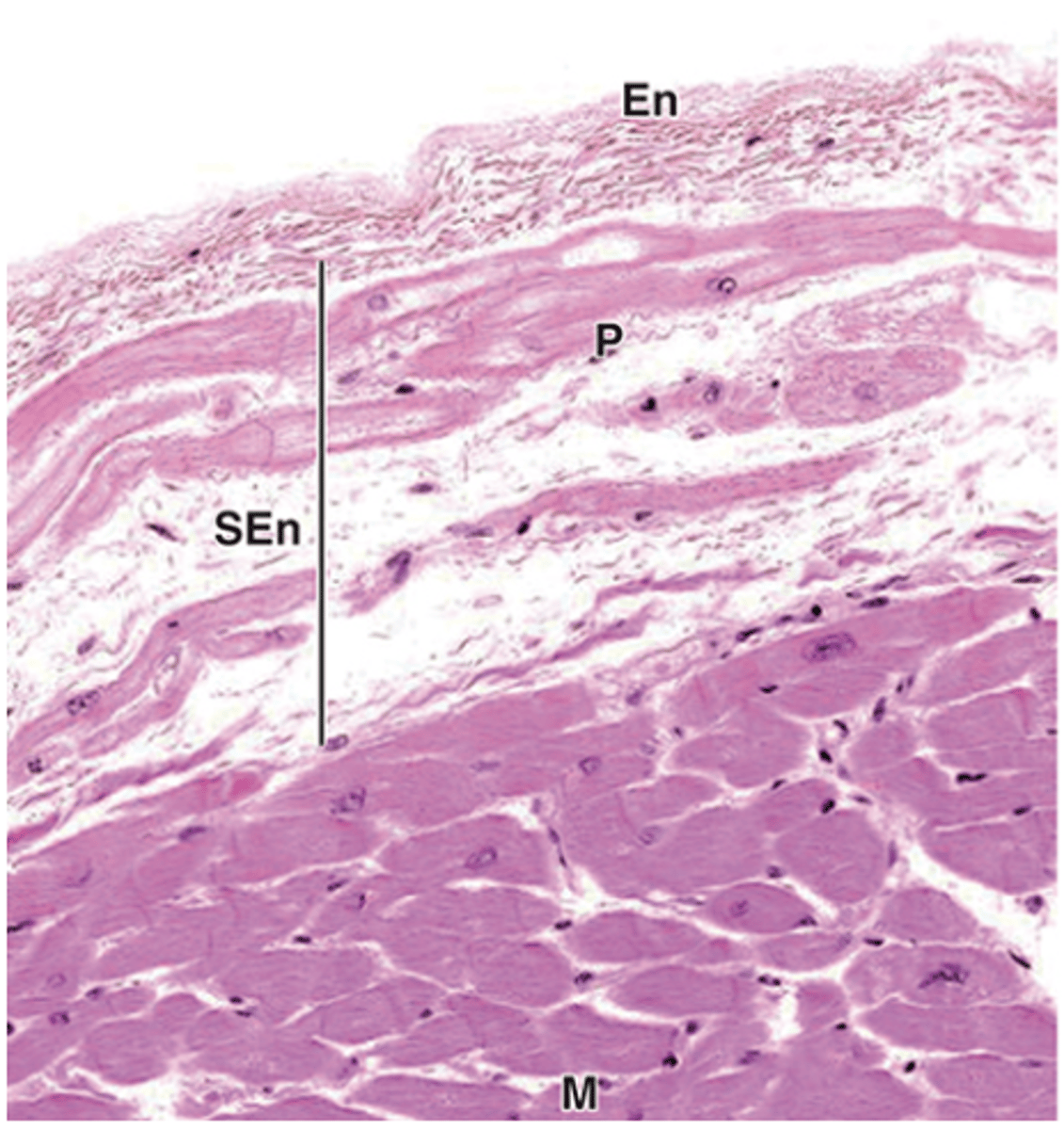 <p>What is the subendothelial layer of the endocardium composed of?</p>