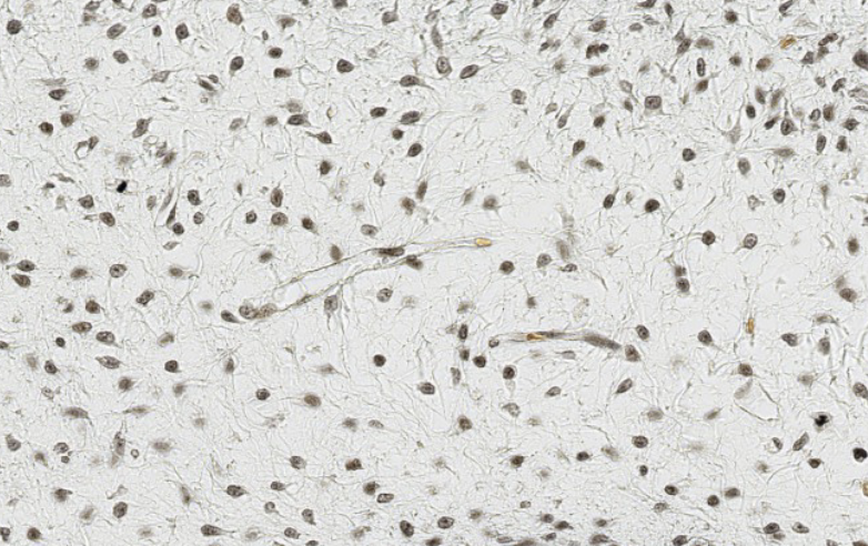 <p>ID the embryonic CT</p>