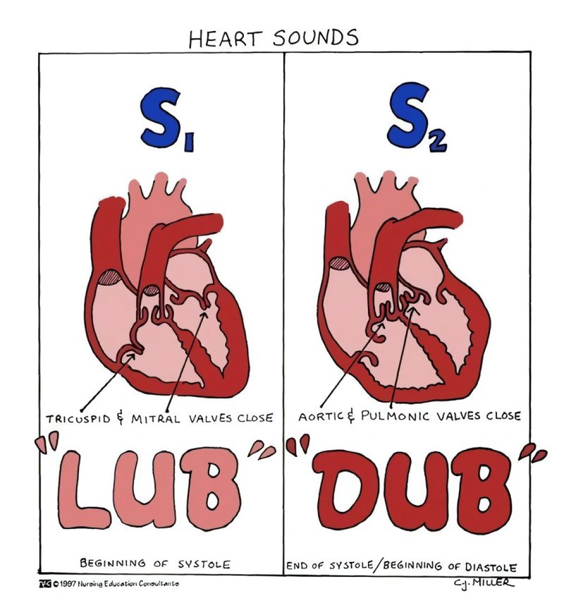 <p>What are the heart sounds you hear. what is a heart murmur</p>