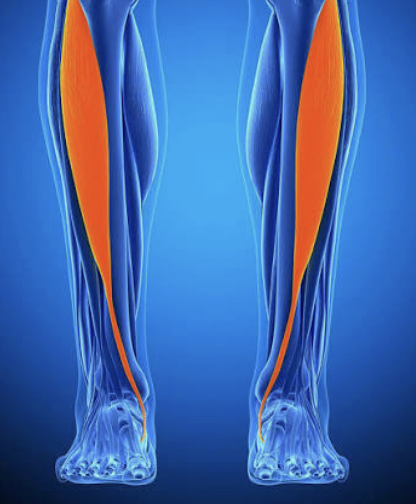 <p>Which muscle is this?</p>