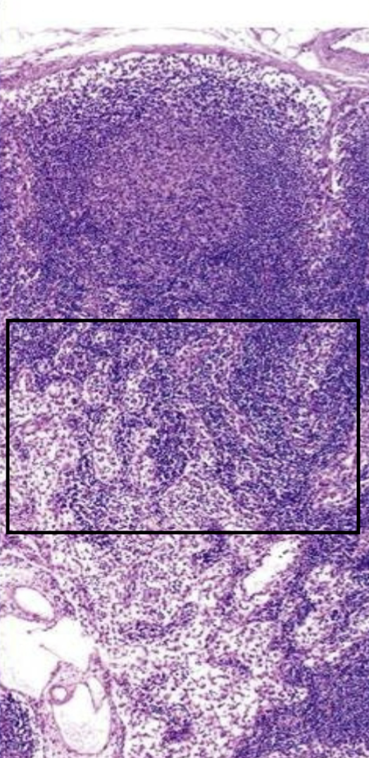 <p>What is this boxed in area of the lymph node that houses a lot of t-cells?</p>