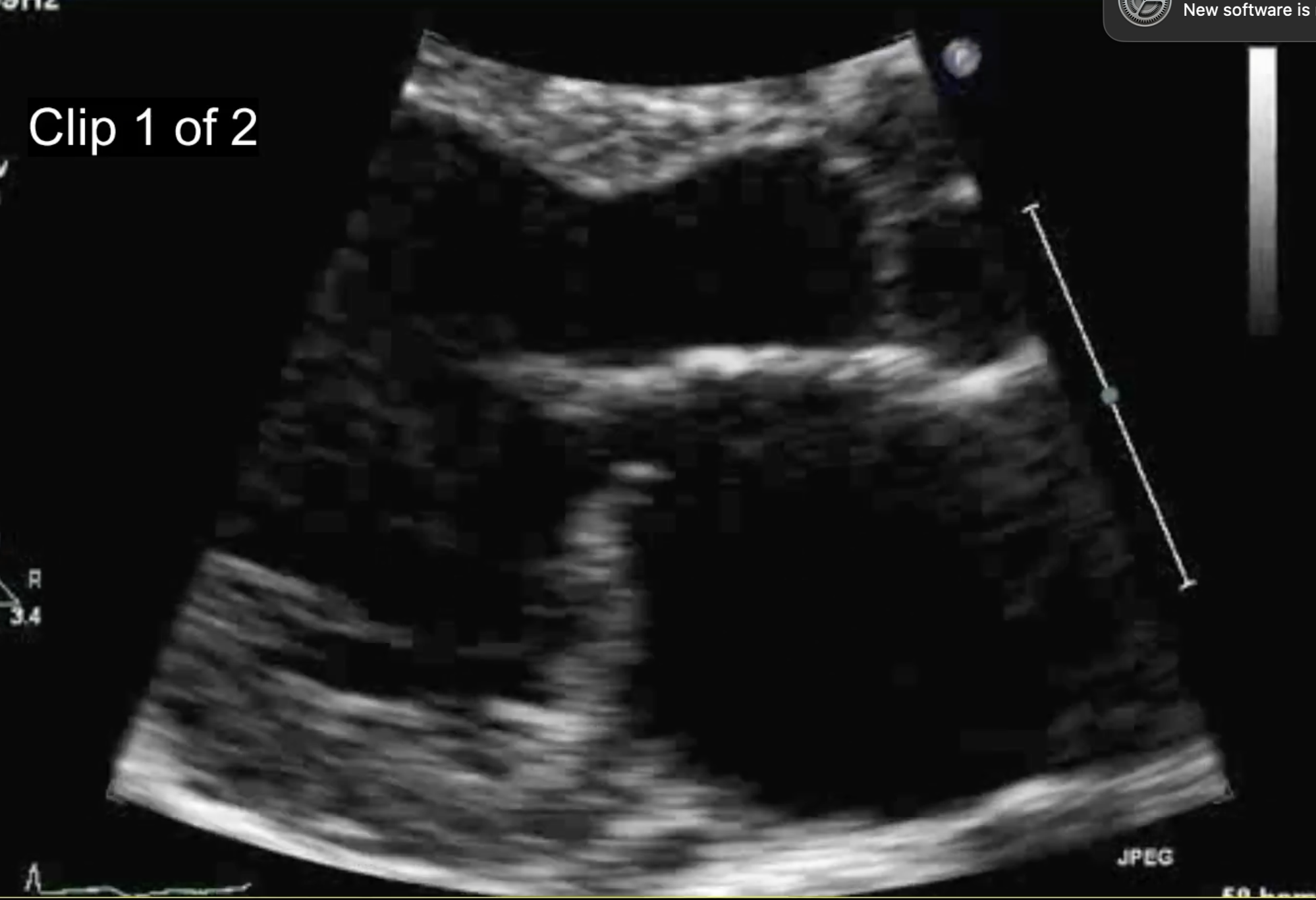 <p>What would the immediate consequences of this be?</p>