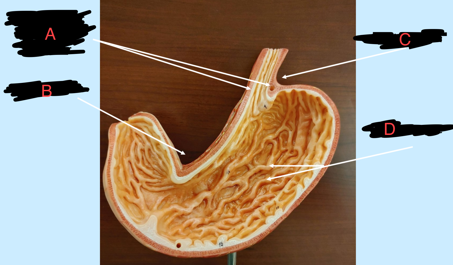 <p>what’s labeled</p>