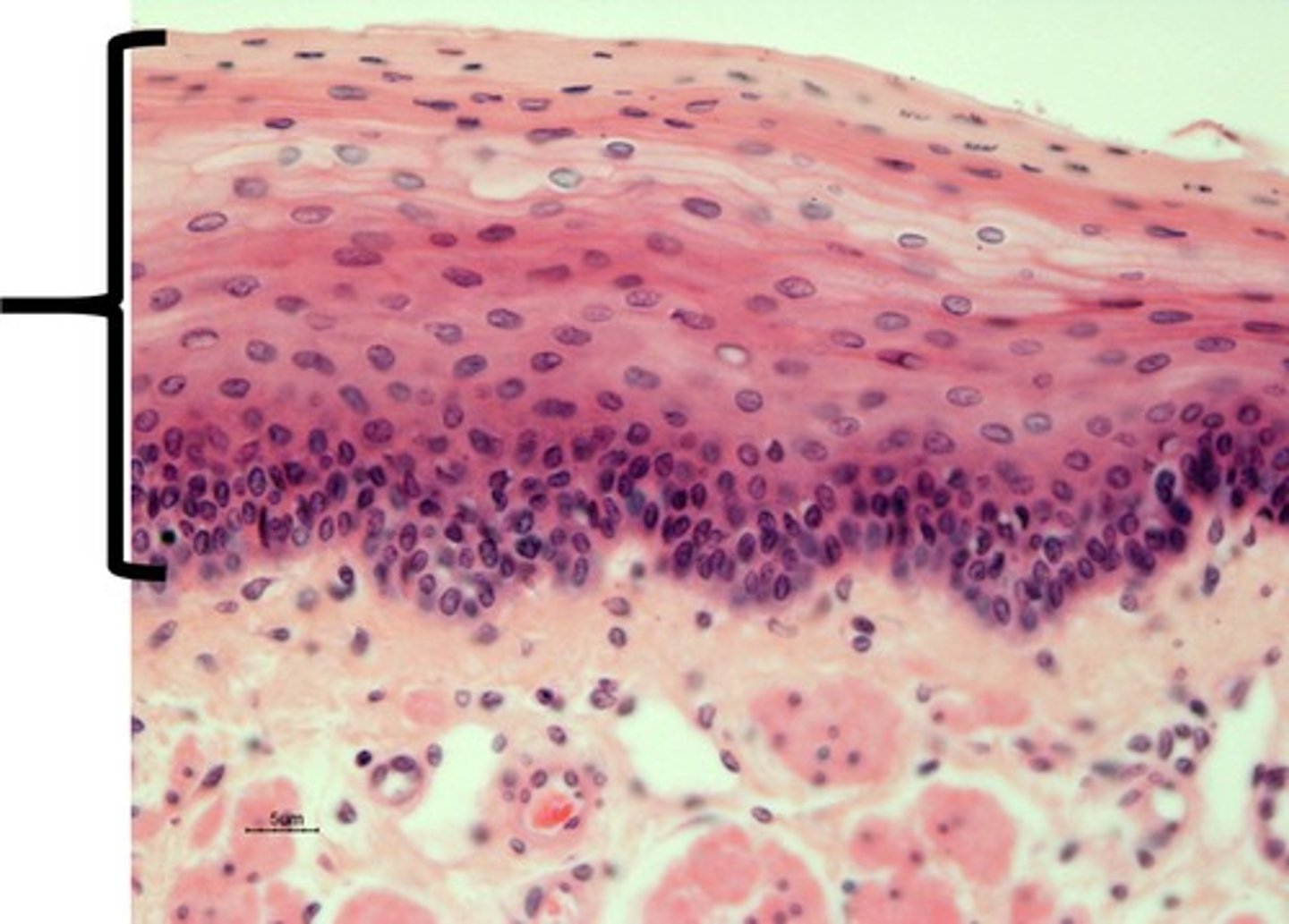<p>type of tissue present?</p>