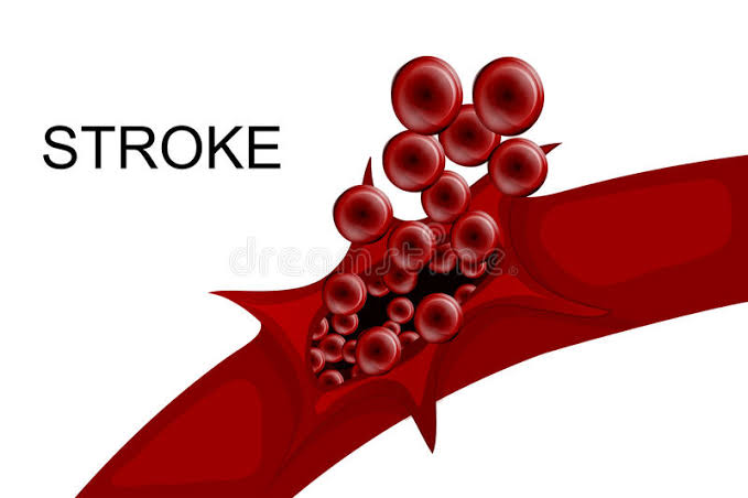<p>Blood Vessel </p>