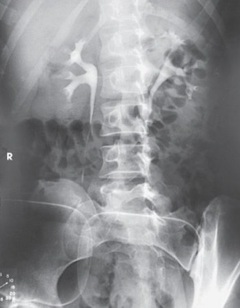 <p>What is this projection?</p>